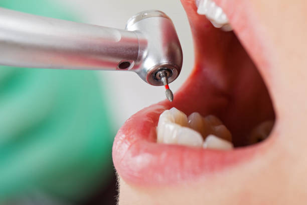 Best Pediatric Emergency Dentist in Bluewell, WV